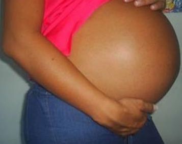 Pregnant women dying at Woloteng due to lack of health facility