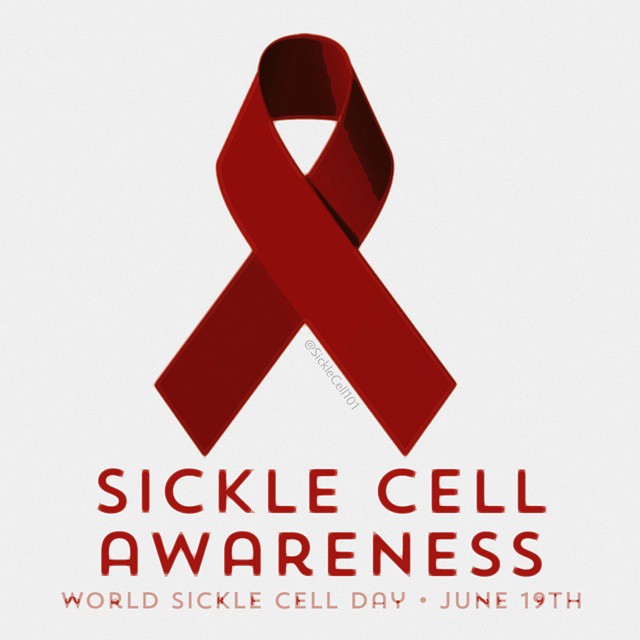 Sickle cell patients must not join queues at the hospital