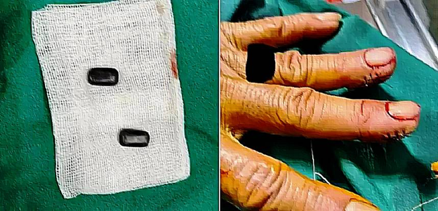 Thai man inserts magnets in fingertips to cheat in illegal gambling